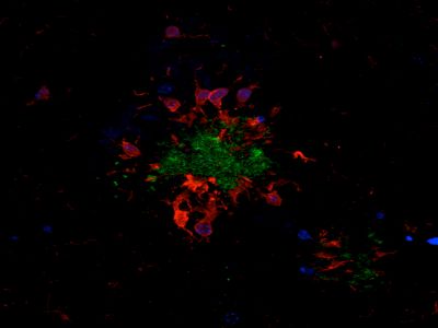 Goat Anti-Human Lambda Chain Antibody, AMCA