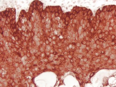 VECTASTAIN? Elite ABC-HRP Kit, Peroxidase (Sheep IgG)