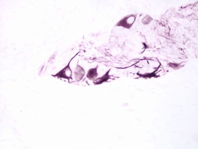 VECTASTAIN? Elite ABC-HRP Kit, Peroxidase (Sheep IgG)