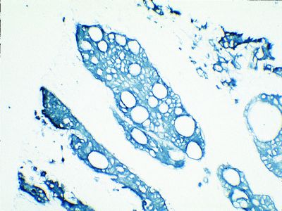 VECTASTAIN? Elite ABC-HRP Kit, Peroxidase (Sheep IgG)