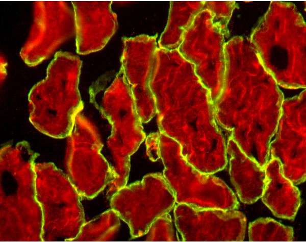 M.O.M.? (Mouse on Mouse) Immunodetection Kit, Basic