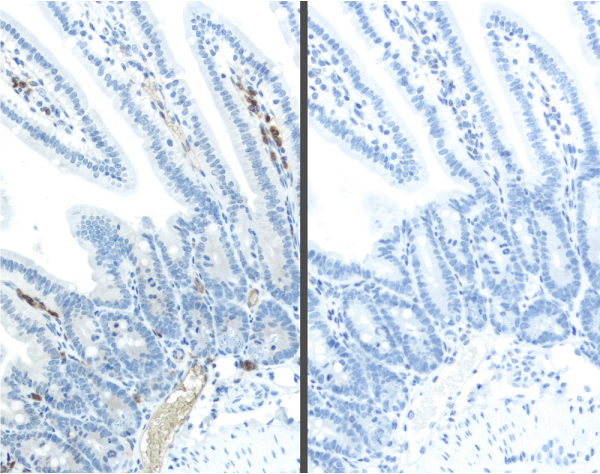 M.O.M.? (Mouse on Mouse) ImmPRESS? Polymer Reagent, Anti-Mouse IgG, Peroxidase