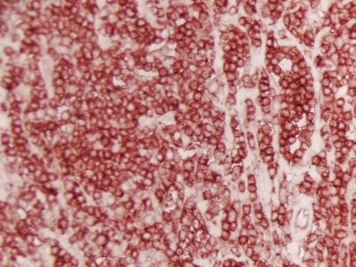 M.O.M.? (Mouse on Mouse) ImmPRESS? Polymer Reagent, Anti-Mouse IgG, Peroxidase