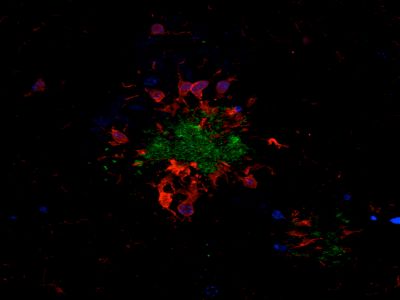 M.O.M.? (Mouse on Mouse) Immunodetection Kit, Fluorescein