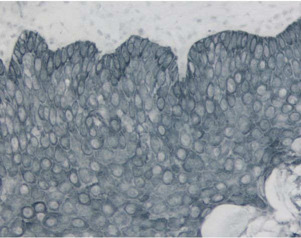 ImmPACT? SG Substrate, Peroxidase (HRP)