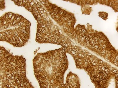 VECTASTAIN? ABC-HRP Kit, Peroxidase (Mouse IgG)
