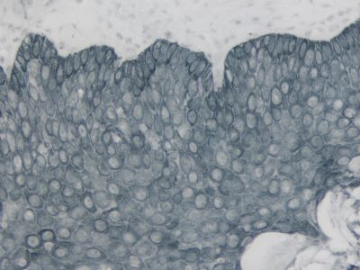 VECTASTAIN? ABC-HRP Kit, Peroxidase (Mouse IgG)