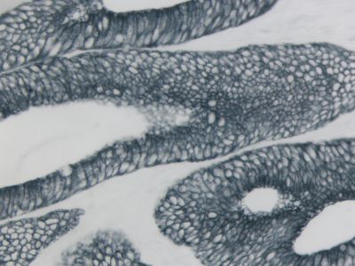 VECTASTAIN? ABC-HRP Kit, Peroxidase (Mouse IgG)