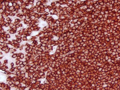 VECTASTAIN? ABC-HRP Kit, Peroxidase (Mouse IgG)
