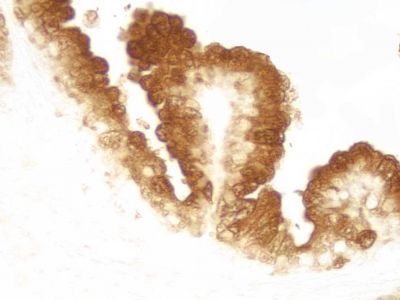 VECTASTAIN? ABC-HRP Kit, Peroxidase (Mouse IgG)