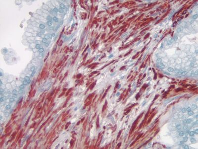 VECTASTAIN? ABC-HRP Kit, Peroxidase (Mouse IgG)