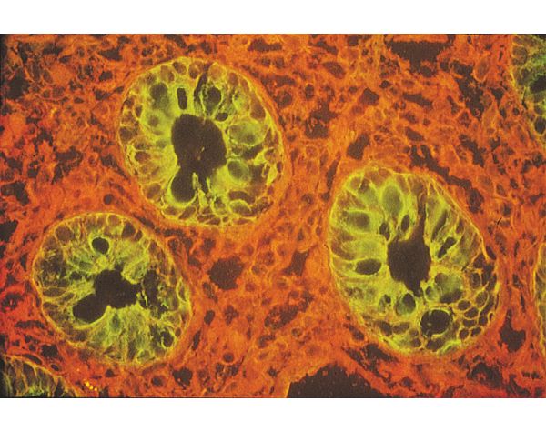 Lycopersicon esculentum (Tomato) Lectin (LEL, TL), Unconjugated