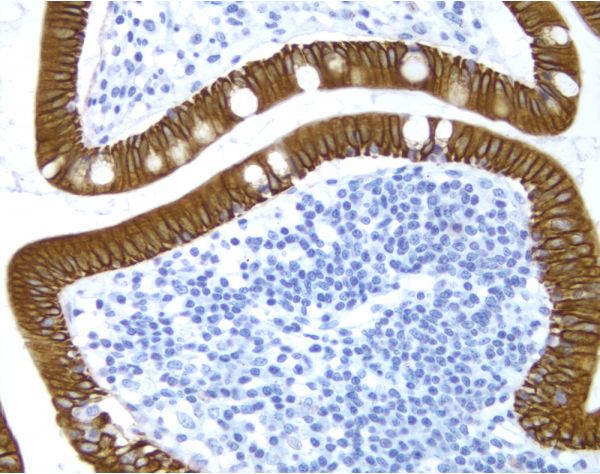 Hematoxylin QS Counterstain