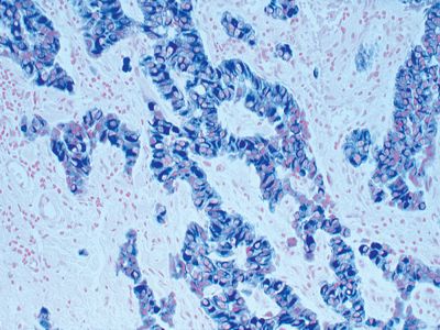 Hematoxylin QS Counterstain