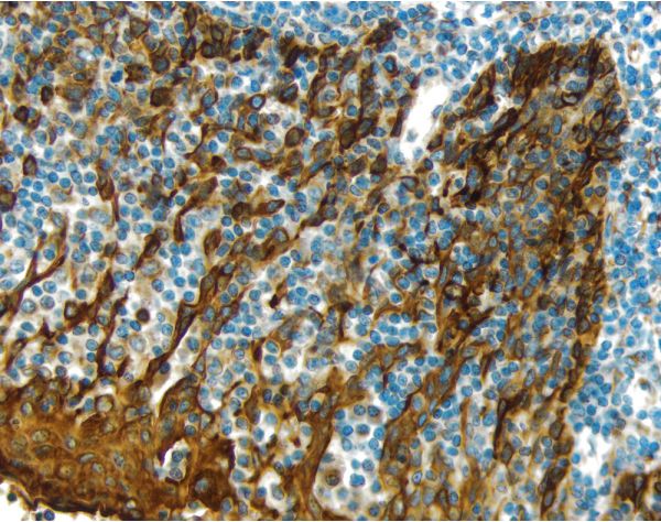 Hematoxylin Counterstain