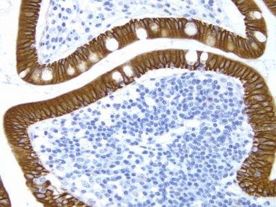 Hematoxylin Counterstain