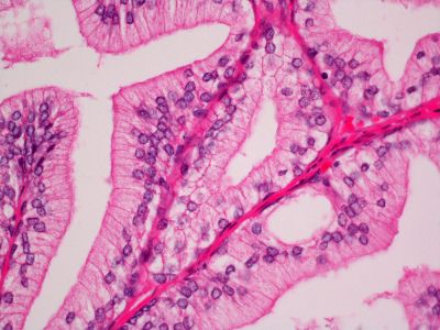 Hematoxylin Counterstain