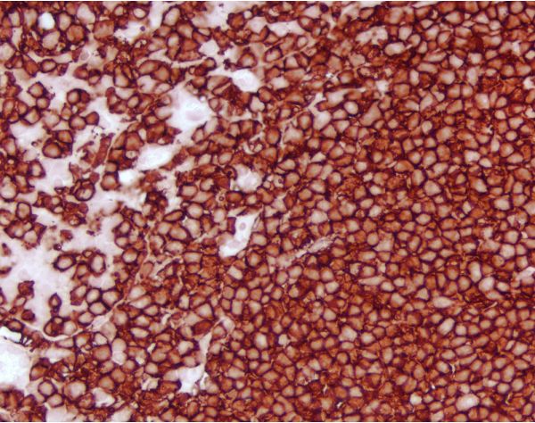 Vector? NovaRED? Substrate Kit, Peroxidase (HRP)