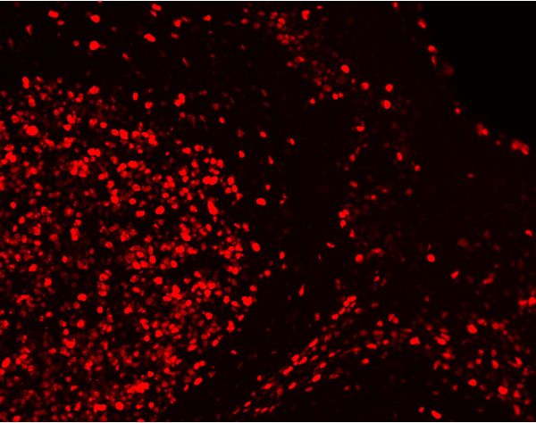 VectaFluor™ Excel Amplified Anti-Rabbit IgG, DyLight? 594 Antibody Kit