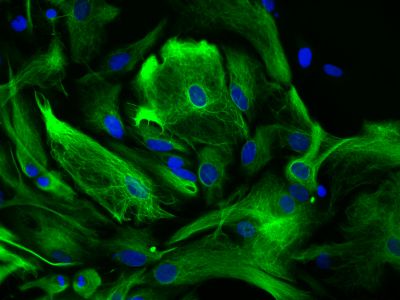 VectaFluor™ Excel Amplified Anti-Rabbit IgG, DyLight? 594 Antibody Kit