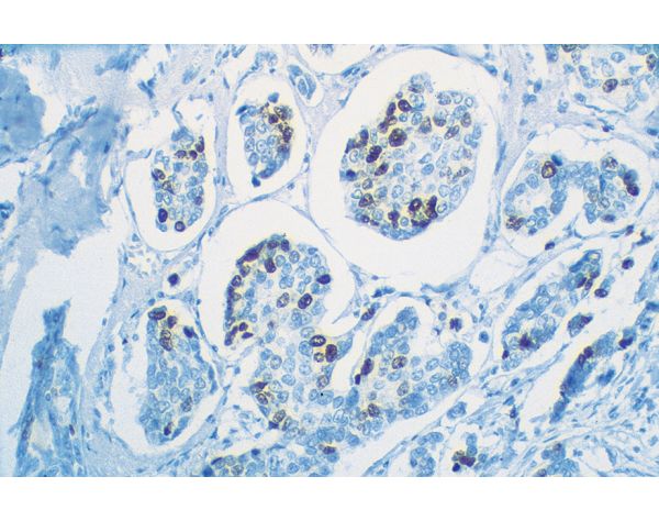 VECTASTAIN? Universal Quick HRP Kit, Peroxidase, R.T.U.