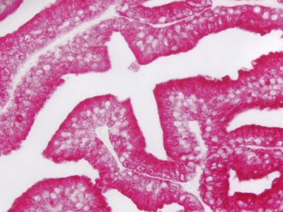 VECTASTAIN? ABC-AmP Reagent (Standard, Western Blot Detection)