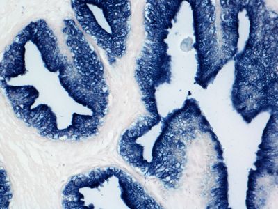 VECTASTAIN? ABC-AmP Reagent (Standard, Western Blot Detection)